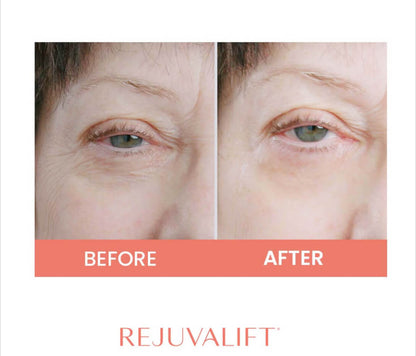 Rejuvalift Advanced Tightening and Lifting Formula - Rejuvalift Beauty